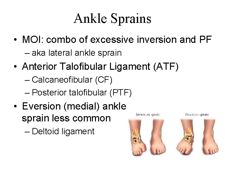 Ankle Sprains • MOI: combo of excessive inversion and PF – aka lateral ankle