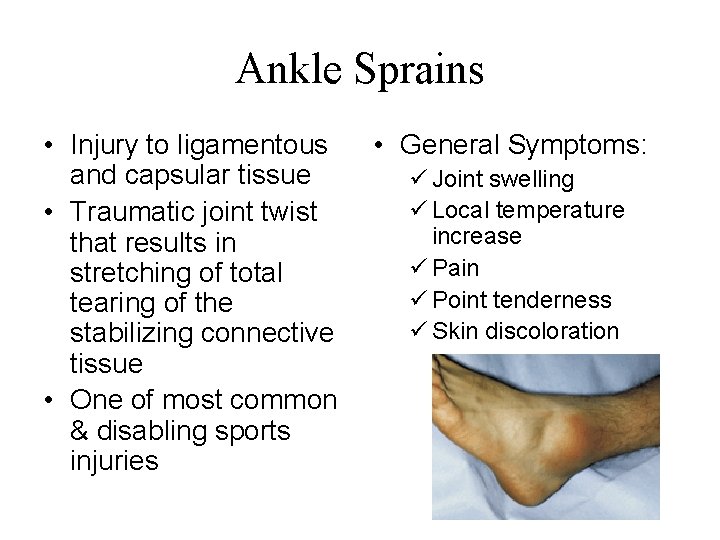 Ankle Sprains • Injury to ligamentous and capsular tissue • Traumatic joint twist that