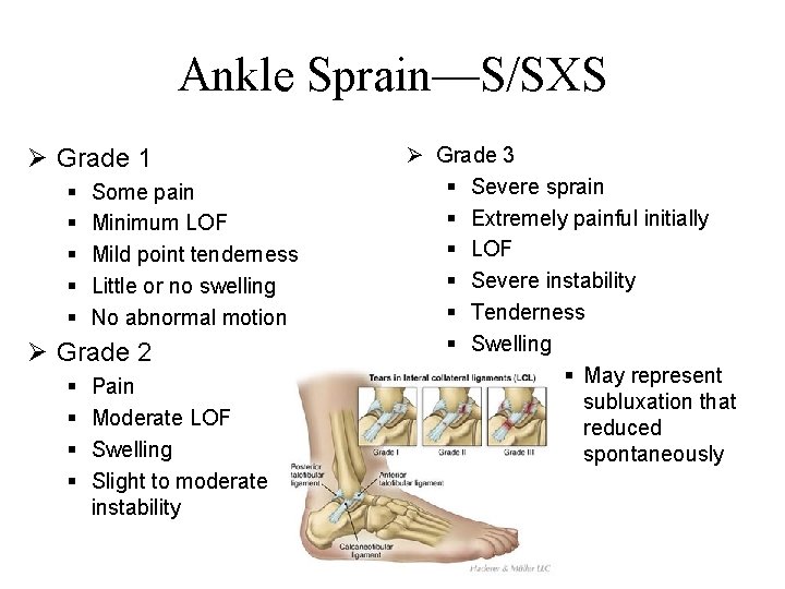 Ankle Sprain—S/SXS Ø Grade 1 § § § Some pain Minimum LOF Mild point