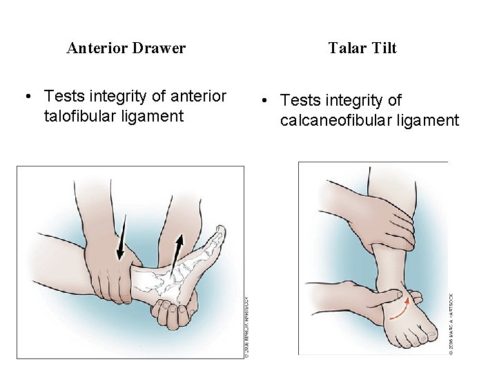 Anterior Drawer Talar Tilt • Tests integrity of anterior talofibular ligament • Tests integrity