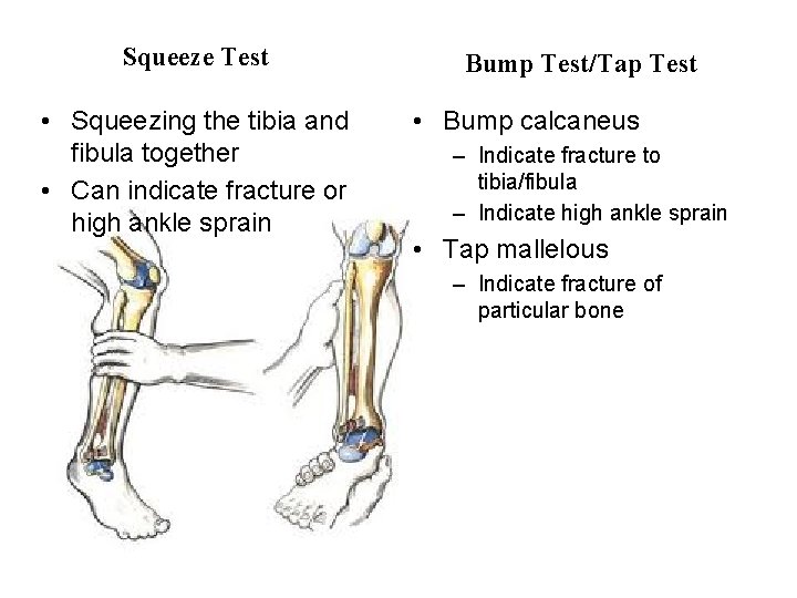 Squeeze Test • Squeezing the tibia and fibula together • Can indicate fracture or