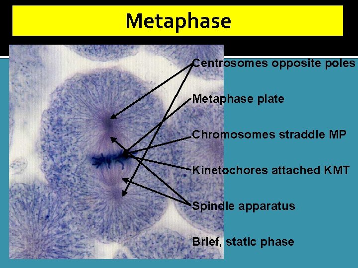 Metaphase Centrosomes opposite poles Metaphase plate Chromosomes straddle MP Kinetochores attached KMT Spindle apparatus