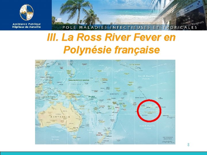III. La Ross River Fever en Polynésie française 8 