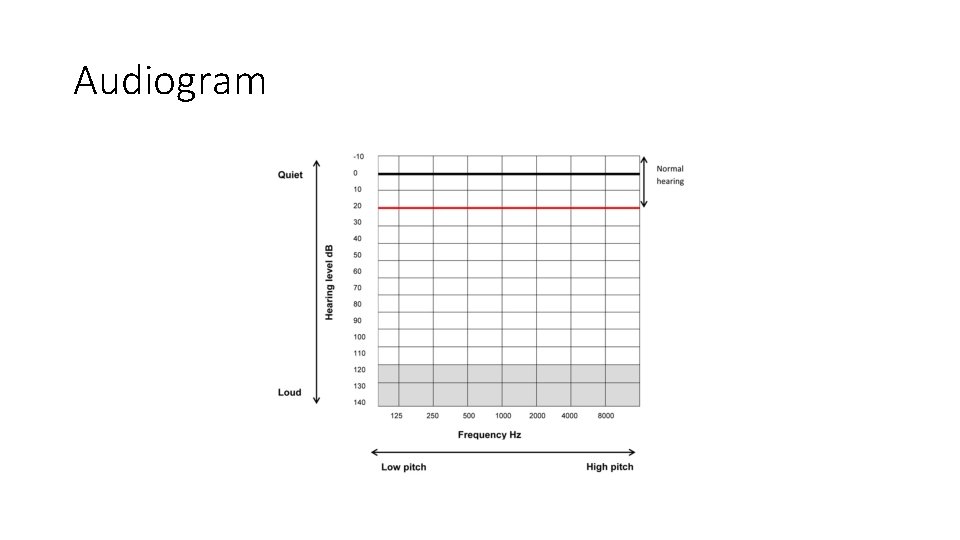 Audiogram Audiogram