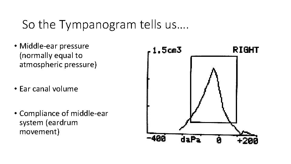 So the Tympanogram tells us…. • Middle-ear pressure (normally equal to atmospheric pressure) •