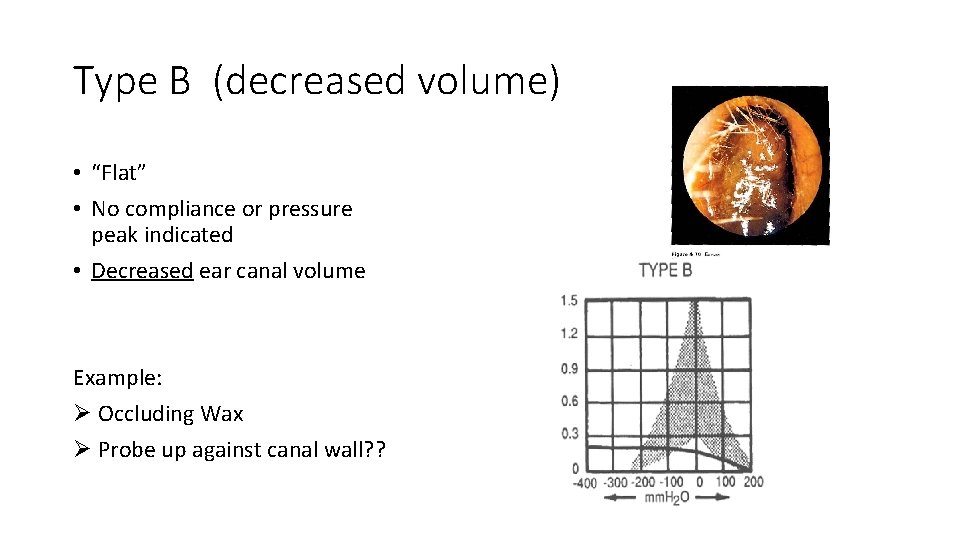 Type B (decreased volume) • “Flat” • No compliance or pressure peak indicated •