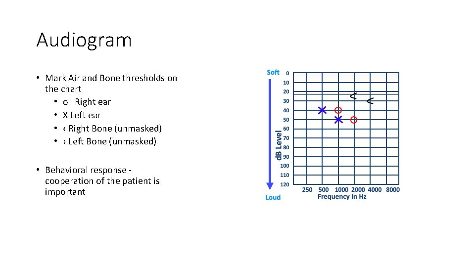 Audiogram • Mark Air and Bone thresholds on the chart • o Right ear Audiogram • Mark Air and Bone thresholds on the chart • o Right ear