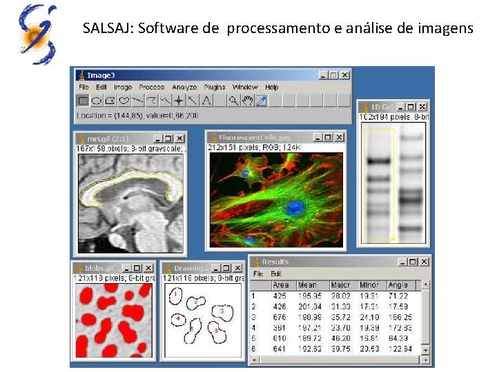 SALSAJ: Software de processamento e análise de imagens 