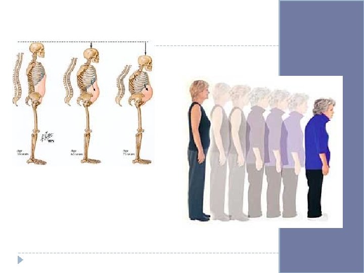 Skeletal System Do Now What are the five