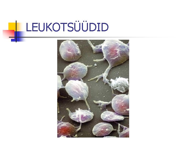 LEUKOTSÜÜDID 