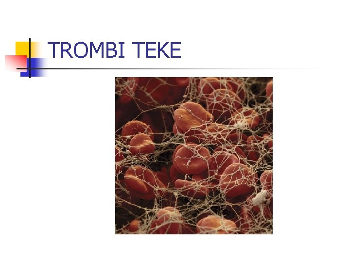 TROMBI TEKE 