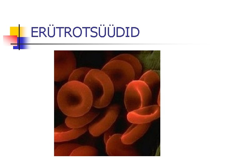 ERÜTROTSÜÜDID 