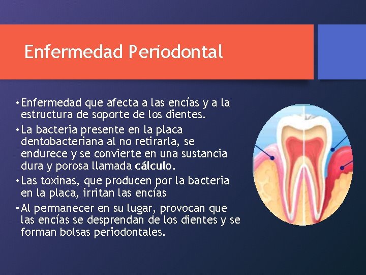 Enfermedad Periodontal • Enfermedad que afecta a las encías y a la estructura de