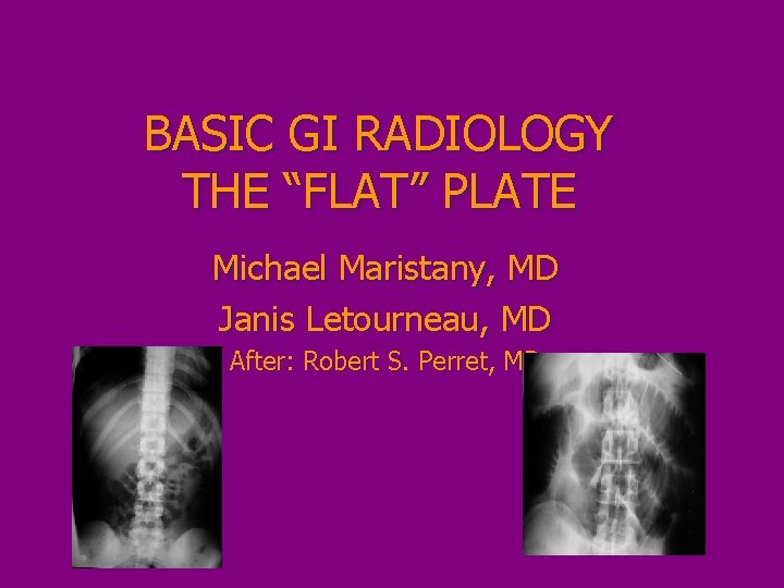 BASIC GI RADIOLOGY THE “FLAT” PLATE Michael Maristany, MD Janis Letourneau, MD After: Robert