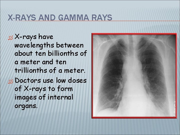 X-RAYS AND GAMMA RAYS X-rays have wavelengths between about ten billionths of a meter