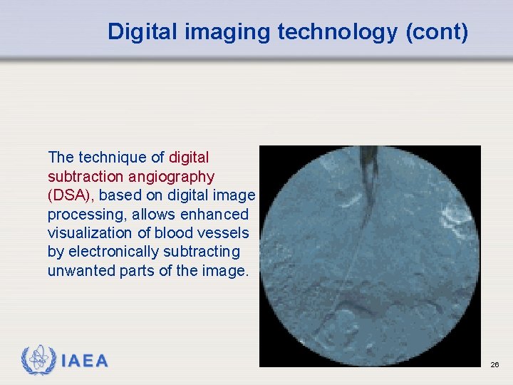 Digital imaging technology (cont) The technique of digital subtraction angiography (DSA), based on digital