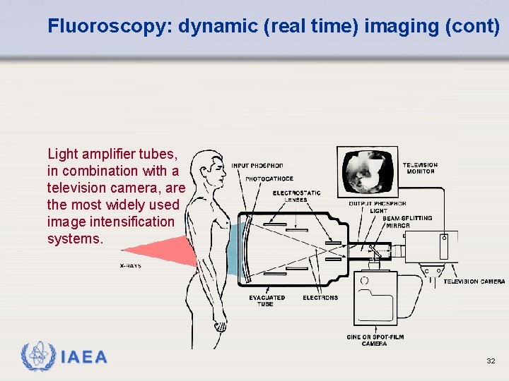 Fluoroscopy: dynamic (real time) imaging (cont) Light amplifier tubes, in combination with a television