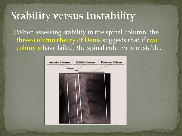 Stability versus Instability �When assessing stability in the spinal column, the three-column theory of