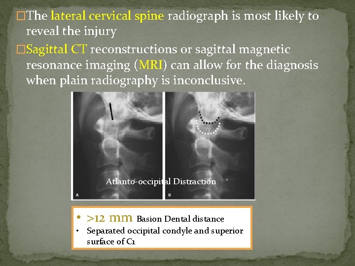 �The lateral cervical spine radiograph is most likely to reveal the injury �Sagittal CT