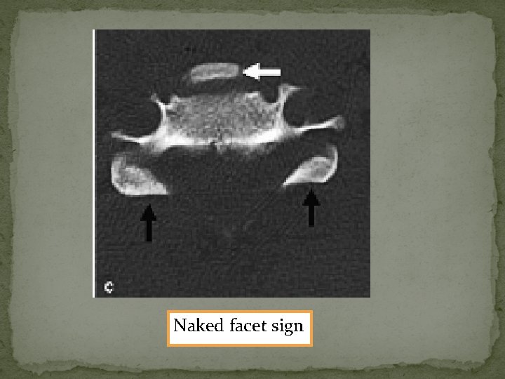 Naked facet sign 