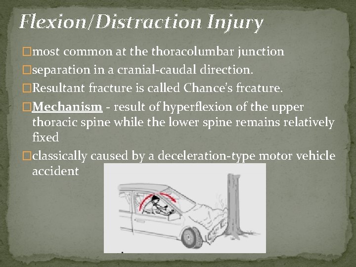 Flexion/Distraction Injury �most common at the thoracolumbar junction �separation in a cranial-caudal direction. �Resultant
