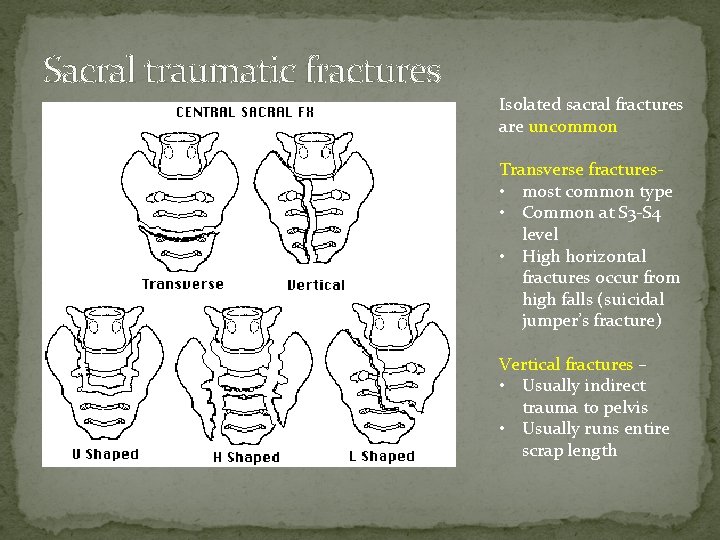 Sacral traumatic fractures Isolated sacral fractures are uncommon Transverse fractures • most common type
