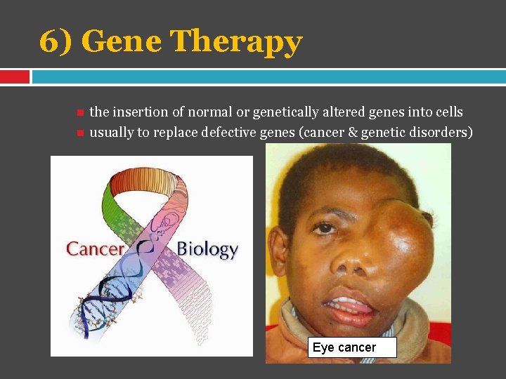6) Gene Therapy the insertion of normal or genetically altered genes into cells usually