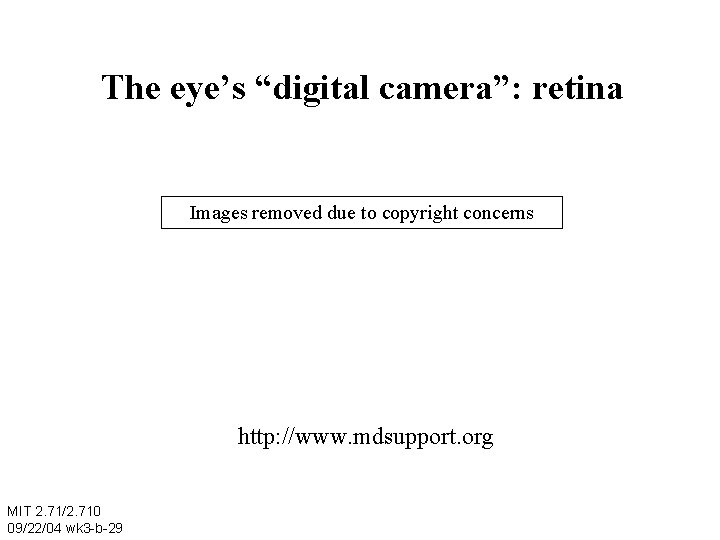 The eye’s “digital camera”: retina Images removed due to copyright concerns http: //www. mdsupport.