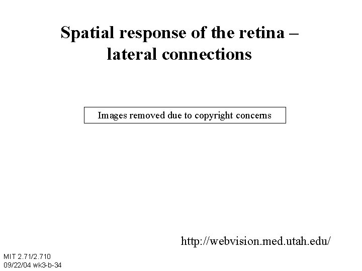Spatial response of the retina – lateral connections Images removed due to copyright concerns