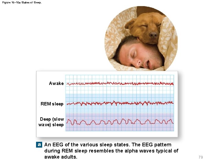 Figure 16– 10 a States of Sleep. Awake REM sleep Deep (slow wave) sleep