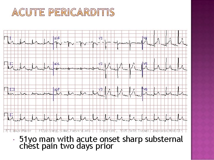  51 yo man with acute onset sharp substernal chest pain two days prior