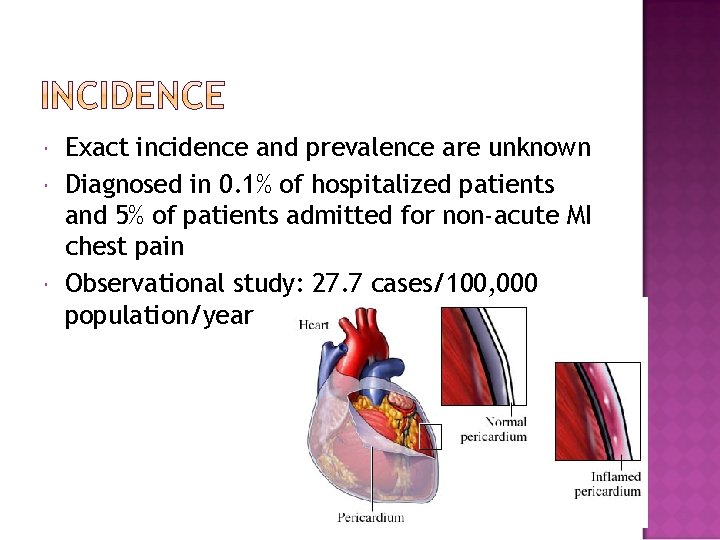  Exact incidence and prevalence are unknown Diagnosed in 0. 1% of hospitalized patients