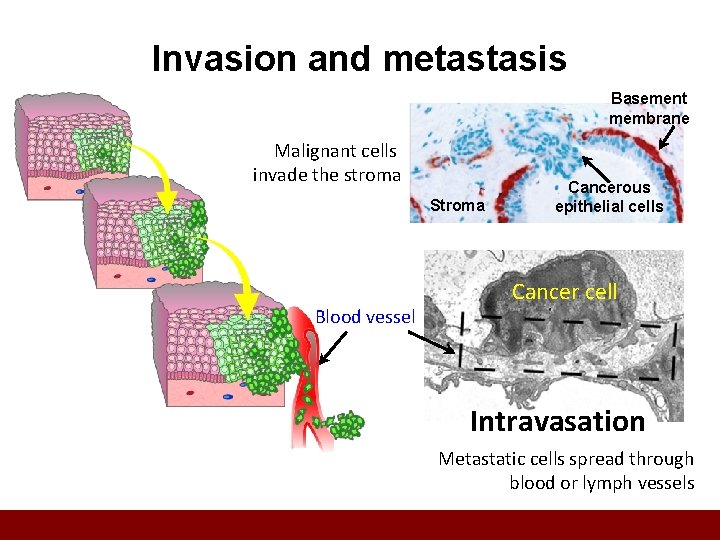Cancer Lesson 4 2 How do tumor cells