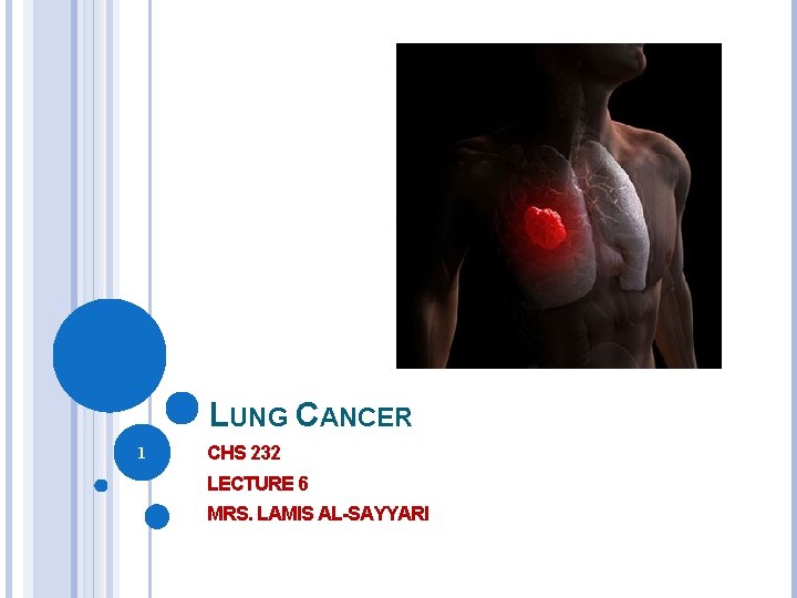 LUNG CANCER 1 CHS 232 LECTURE 6 MRS. LAMIS AL-SAYYARI 