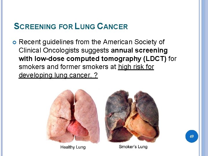 SCREENING FOR LUNG CANCER Recent guidelines from the American Society of Clinical Oncologists suggests