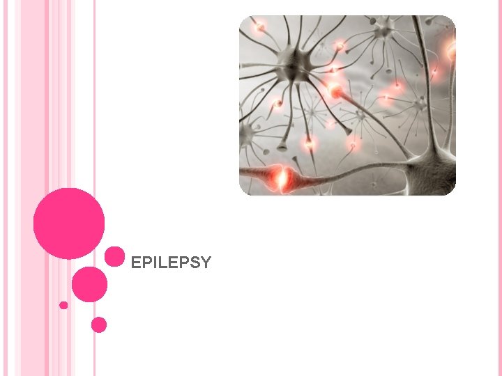 EPILEPSY 