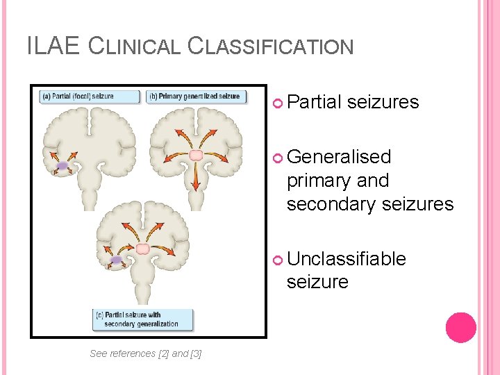 ILAE CLINICAL CLASSIFICATION Partial seizures Generalised primary and secondary seizures Unclassifiable seizure See references
