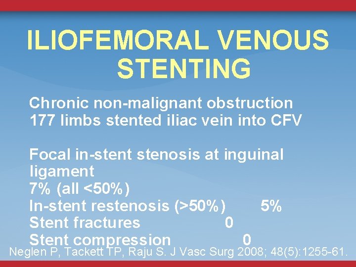 ILIOFEMORAL VENOUS STENTING Chronic non-malignant obstruction 177 limbs stented iliac vein into CFV Focal