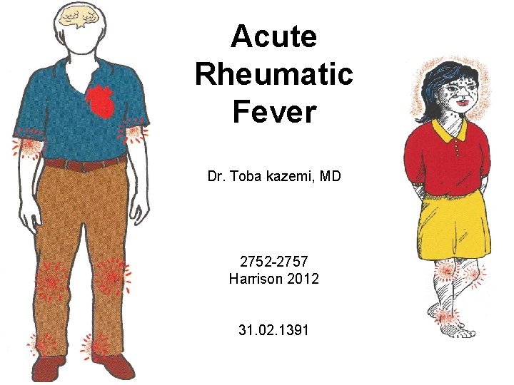 Acute Rheumatic Fever Dr. Toba kazemi, MD 2752 -2757 Harrison 2012 31. 02. 1391