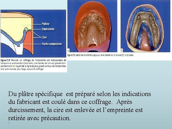 Du plâtre spécifique est préparé selon les indications du fabricant est coulé dans ce