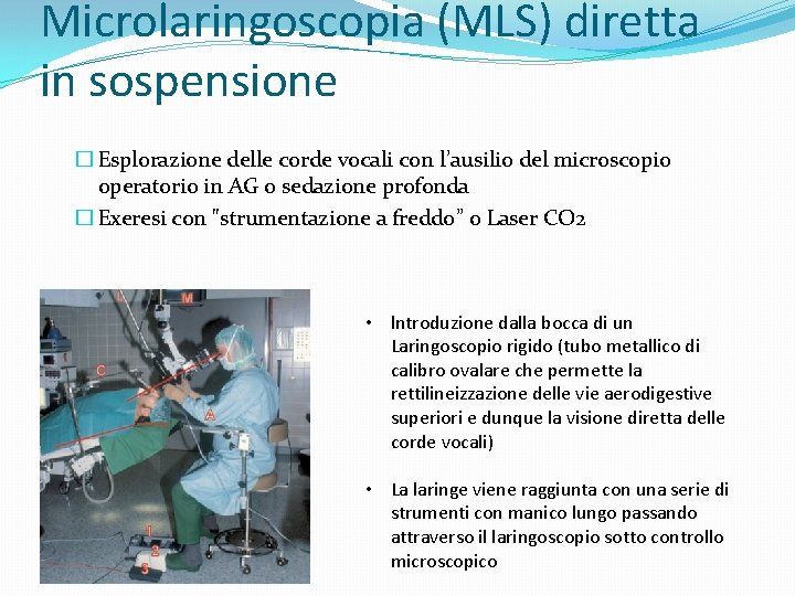 Microlaringoscopia (MLS) diretta in sospensione � Esplorazione delle corde vocali con l’ausilio del microscopio