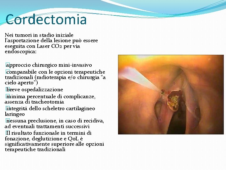 Cordectomia Nei tumori in stadio iniziale l’asportazione della lesione può essere eseguita con Laser