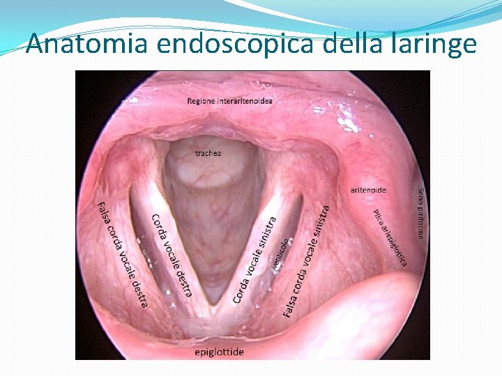 Anatomia endoscopica della laringe 