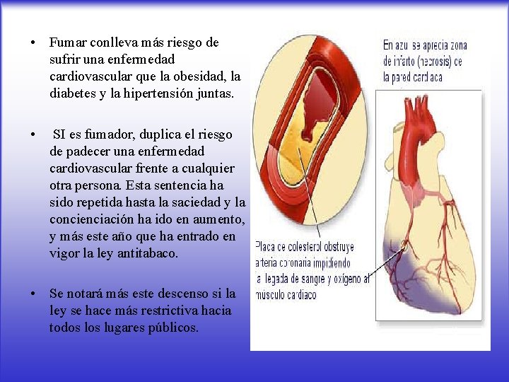  • Fumar conlleva más riesgo de sufrir una enfermedad cardiovascular que la obesidad,