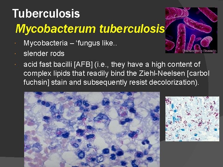 Tuberculosis Mycobacterum tuberculosis Mycobacteria – ‘fungus like. . slender rods acid fast bacilli [AFB]