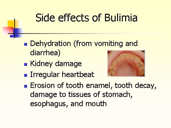 Side effects of Bulimia n n Dehydration (from vomiting and diarrhea) Kidney damage Irregular