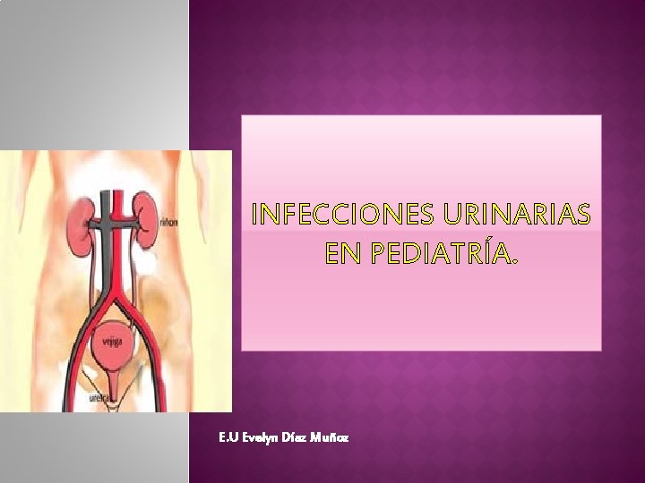 INFECCIONES URINARIAS EN PEDIATRÍA. E. U Evelyn Díaz Muñoz 