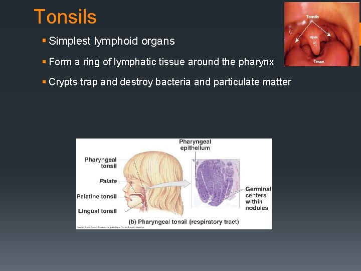 Tonsils § Simplest lymphoid organs § Form a ring of lymphatic tissue around the
