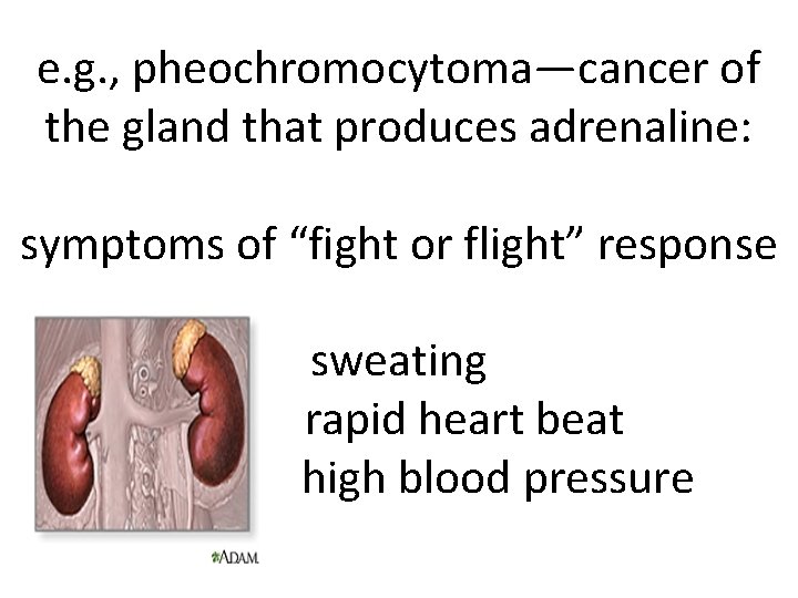 e. g. , pheochromocytoma—cancer of the gland that produces adrenaline: symptoms of “fight or e. g. , pheochromocytoma—cancer of the gland that produces adrenaline: symptoms of “fight or