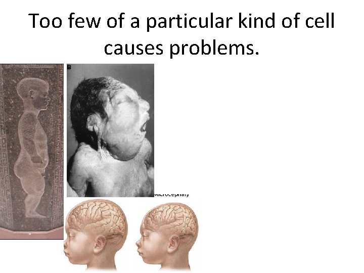 Too few of a particular kind of cell causes problems. Too few of a particular kind of cell causes problems.
